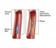 USA Vascular Centers Yonkers, NY 